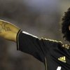 Marcelo, de la Real Madrid, operat cu succes