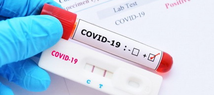 FC Argeş a făcut al treilea test COVID-19