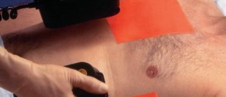 FRF va achizitiona defibrilatoare pentru toate cluburile in urma decesului lui Ekeng